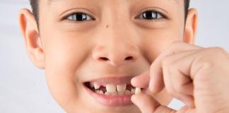 Схема выпадения молочных и роста постоянных зубов у детей Как должны выпадать молочные зубы у детей