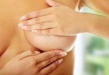 Фиброзно-кистозная мастопатия: лечение, симптомы, причины, профилактика
