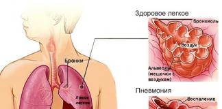 Пневмония при лактации, можно ли впоследствии возобновлять кормления?