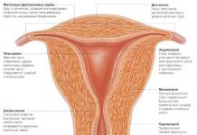 Separation of the uterus from the vaginal vault (colpoporrhexis)