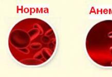 Anemia sa mga bata Ang bata ay may iron deficiency anemia 2 taon