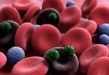 Bolesti krvi - klasifikacija, znaci i simptomi, sindromi bolesti krvi, dijagnoza (krvni testovi), metode liječenja i prevencije PMG bolesti