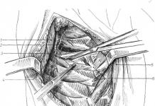 رویکردهای جراحی به اعصاب اندام ها جابجایی عصب اولنار به حفره کوبیتال