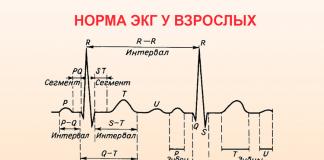 Karakteristike EKG-a tokom infarkta miokarda - postupak i znakovi bolesti
