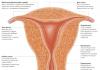Separarea uterului de bolta vaginală (colpoporrexie)