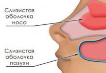 Kāda ir atšķirība starp sinusītu un rinītu un kā ārstēt sinusoidālo rinītu