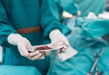 Chirurgie de îndepărtare a plămânilor pentru cancerul pulmonar: o revizuire completă